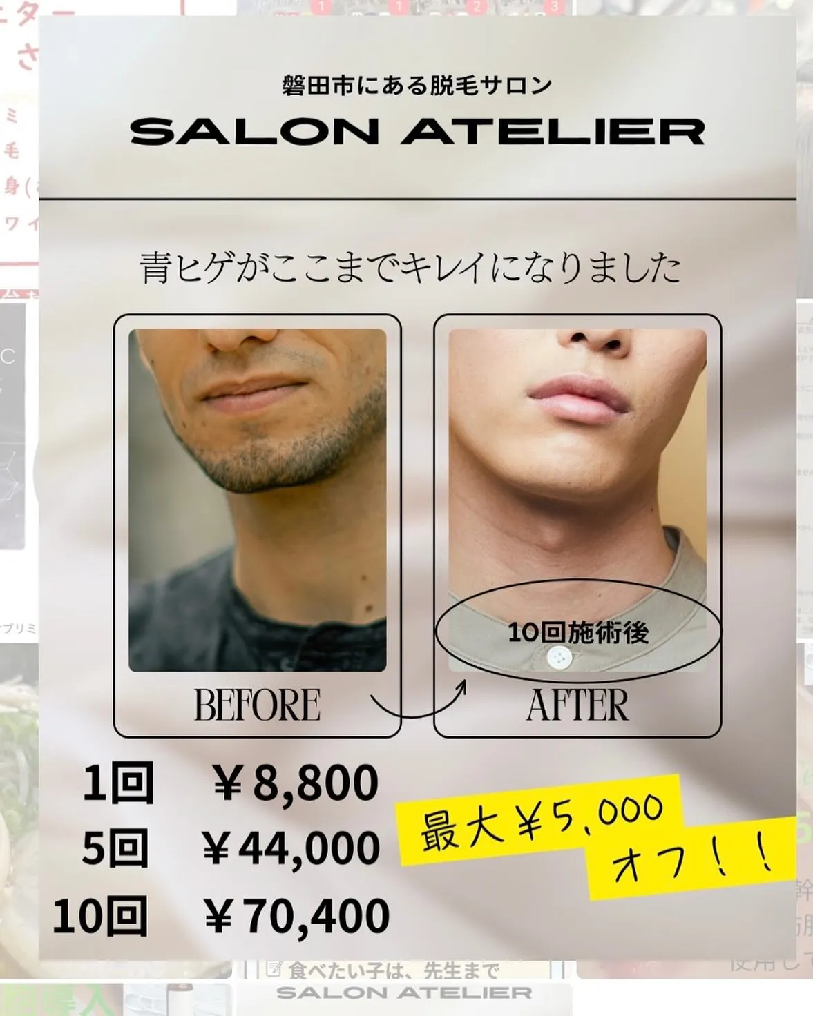 🔥毎朝のヒゲ剃り、もう卒業しませんか?🔥