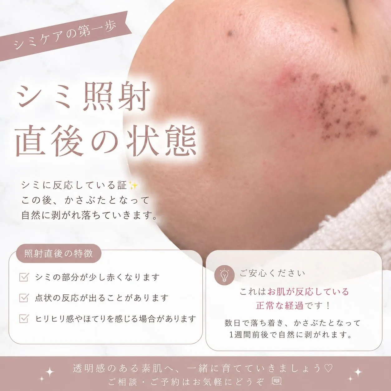 丸くて大きなシミも、諦めないで。