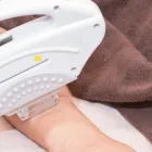 脱毛